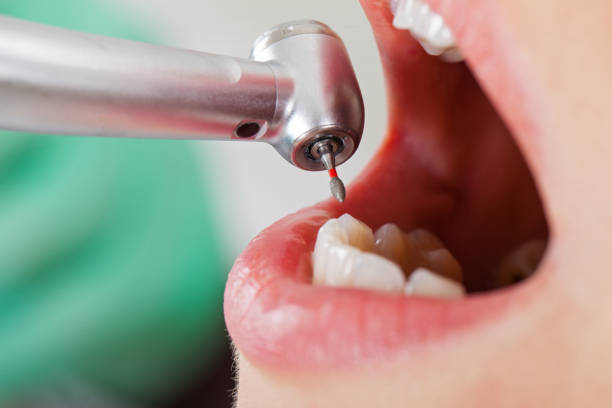 Professional Emergency Dental Service in MN